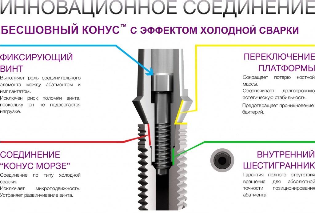 БЕСШОВНЫЙ КОНУС. ОРТОПЕДИЧЕСКИЙ РАЗДЕЛ САЙТА..jpg